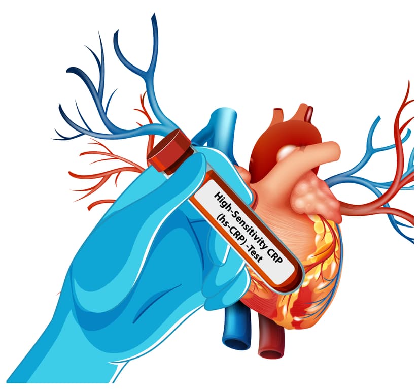 Cardiovascular Health